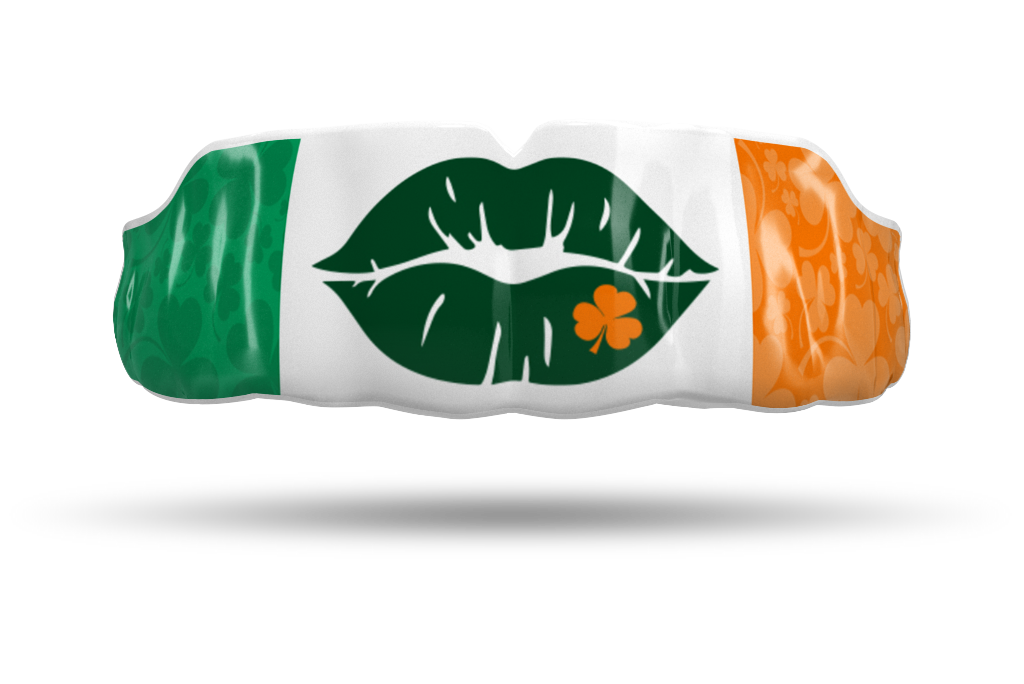 Irish Kiss
