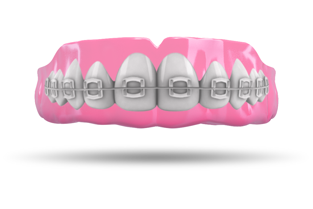 Pink Braces