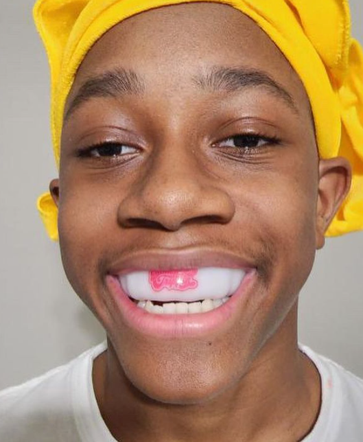 Bitches be Trippin Mouthguard