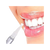 Bright Smile - Teeth Whitening Pen